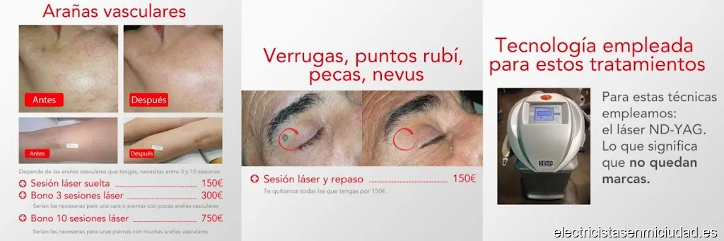 Imagen 3